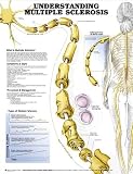 Understanding Multiple Sclerosis Anatomical Chart