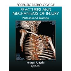 Forensic Pathology of Fractures and Mechanisms of Injury: Postmortem CT Scanning by Michael P. Burke