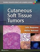 Cutaneous Soft Tissue Tumors Cutaneous Soft Tissue Tumors