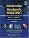 Molecular Anatomic Imaging: PET-CT and SPECT-CT Integrated Modality Imaging