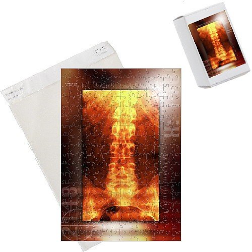 Jigsaw Puzzles of Healthy lower back, X-ray from Science Photo Library