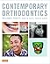 Contemporary orthodontics 