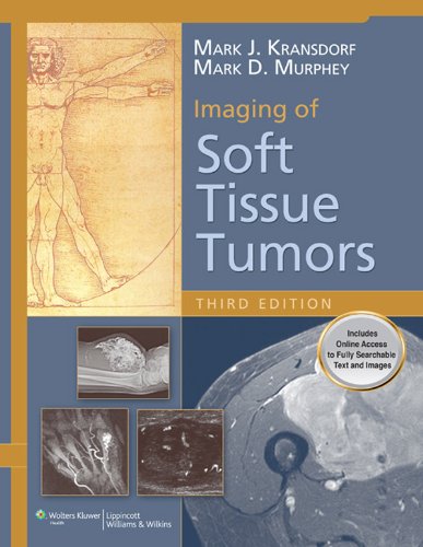 Imaging of Soft Tissue Tumors Imaging of Soft Tissue Tumors