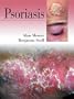 Psoriasis