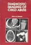 Diagnostic Imaging of Child Abuse
