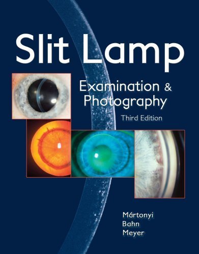 Slit Lamp: Examination and Photography Hardcover November 8, 2007