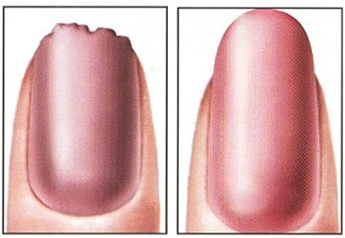 Touch of Diamonds Beautyko Deluxe Nail Growth Formula