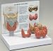 Thyroid Gland Anatomical Model Set