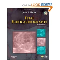 Fetal Echocardiography by Julia A. Drose BA RDMS RDCS RVT