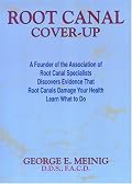 Root Canal Cover Up