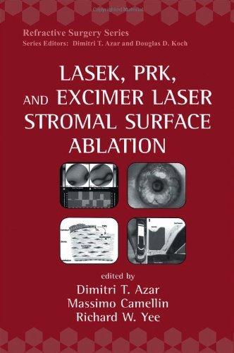 laser ablation