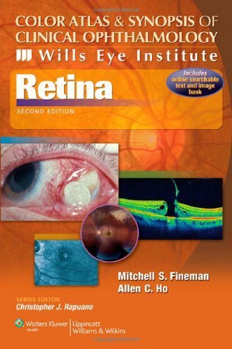 Color Atlas and Synopsis of Clinical Ophthalmology -- Wills Eye Institute -- Retina (Wills Eye Institute Atlas Series) Second Edition by Fineman MD, Mitchell S., Ho MD, Allen C. (2012) Paperback