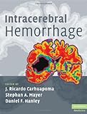 Intracerebral hemorrhage