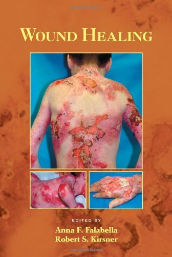 Wound Healing (Basic and Clinical Dermatology) On Sale