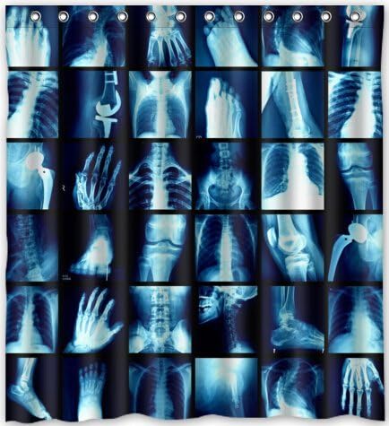 66"(w) x 72"(h) Human Skeleton X-ray Pattern Bathroom Shower Curtain Shower Rings Included, 100% Polyester
