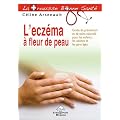L'ecz�ma � fleur de peau