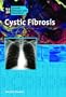 Cystic Fibrosis (Genetic & Developmental Diseases & Disorders)
