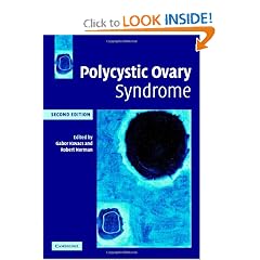 Polycystic Ovary Syndrome by Gabor T. Kovacs and Robert Norman