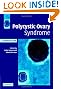 Polycystic Ovary Syndrome