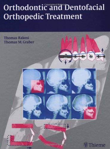 Orthodontic Therapy
