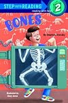 Bones