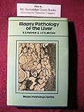 Biopsy pathology of the liver