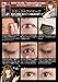 AB Mezical Natural Eye Tape