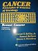 Books : Cancer Principles & Practice of Oncology Breast Cancer (Breast Cancer 'Lilly Oncology')