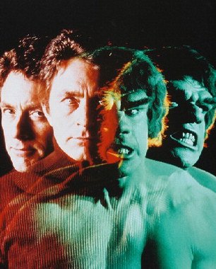 Bill Bixby As Dr. David Bruce Banner From The Incredible Hulk #1 - Colour - 20" X 16" (50cm X 40cm) Framed Movie Art Giclee Canvas Print Picture