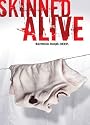 Skinned Alive