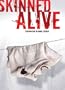 Skinned Alive
