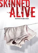 Skinned Alive