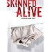 Skinned Alive