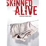 Skinned Alive
