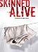 Search : Skinned Alive