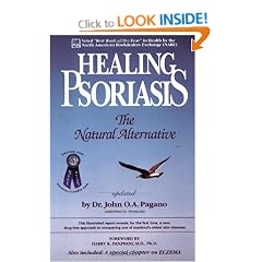 Healing Psoriasis: The Natural Alternative