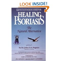 Healing Psoriasis: The Natural Alternative