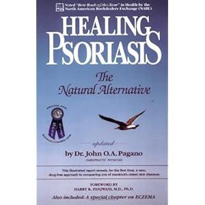 Healing Psoriasis: The Natural Alternative