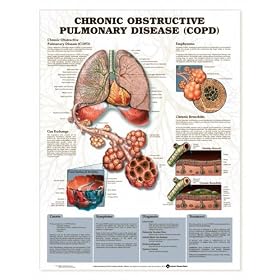 Chronic Obstructive Pulmonary Disease (COPD) Anatomical Chart Unmounted-9783PU by