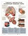 Chronic Obstructive Pulmonary Disease (COPD) Anatomical Chart Unmounted-9783PU