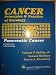 Books : Cancer Principles & Practice of Oncology Pancreatic Cancer (Lilly Oncology)