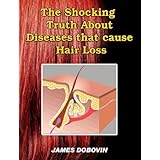 The Shocking Truth about Diseases that Cause Hair Loss