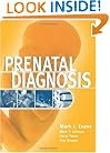 Prenatal Diagnosis