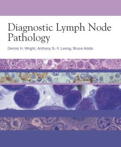 Lymph-Nodes