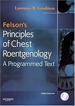 Felson's Principles of Chest Roentgenology