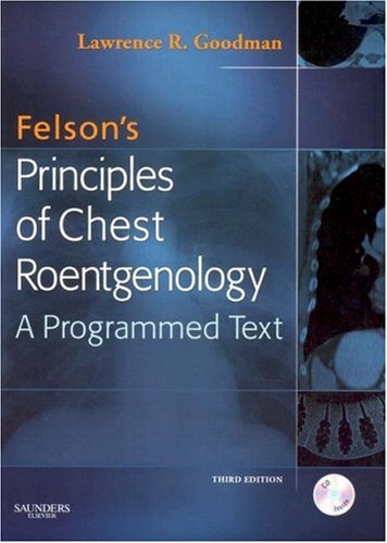 Felson's Principles of Chest Roentgenology Text with CD-ROM (Goodman, Felson's Principles of Chest Roentgenology)
