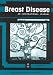 Genomic Approaches to the Study of Breast Cancer (Breast Disease)