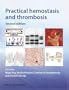 Practical Hemostasis and Thrombosis
