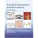 Practical Hemostasis and Thrombosis