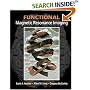 Functional Magnetic Resonance Imaging